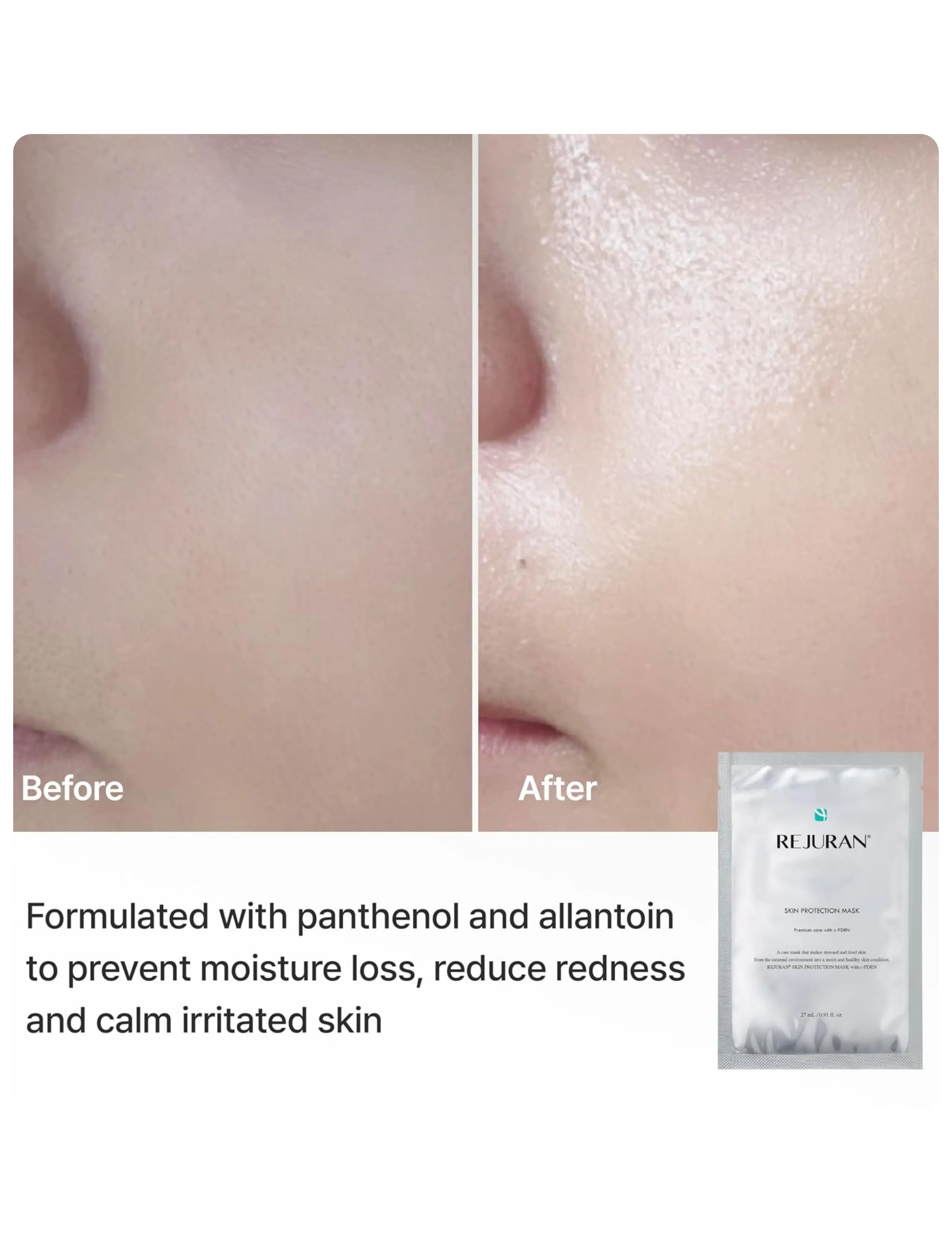 Rejuran - Skin Protection Mask - sheet masks - clear - 2