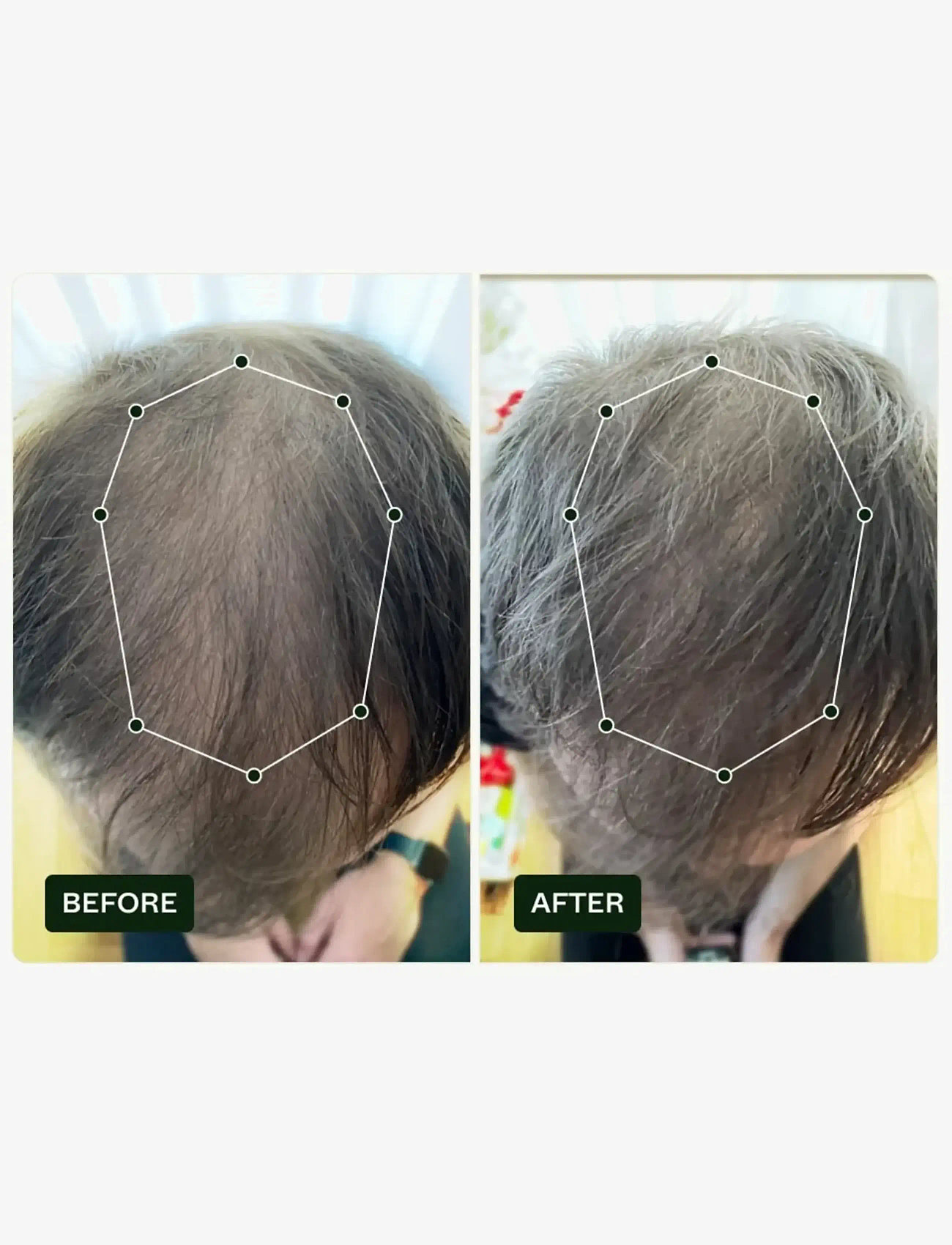 Scandinavian Biolabs - Bio-Pilixin® Serum+ | For Men - hårkur - n/a - 2