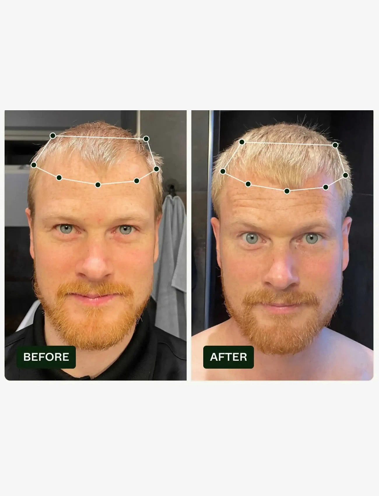 Scandinavian Biolabs - Bio-Pilixin® Serum+ | For Men - hårkur - n/a - 3