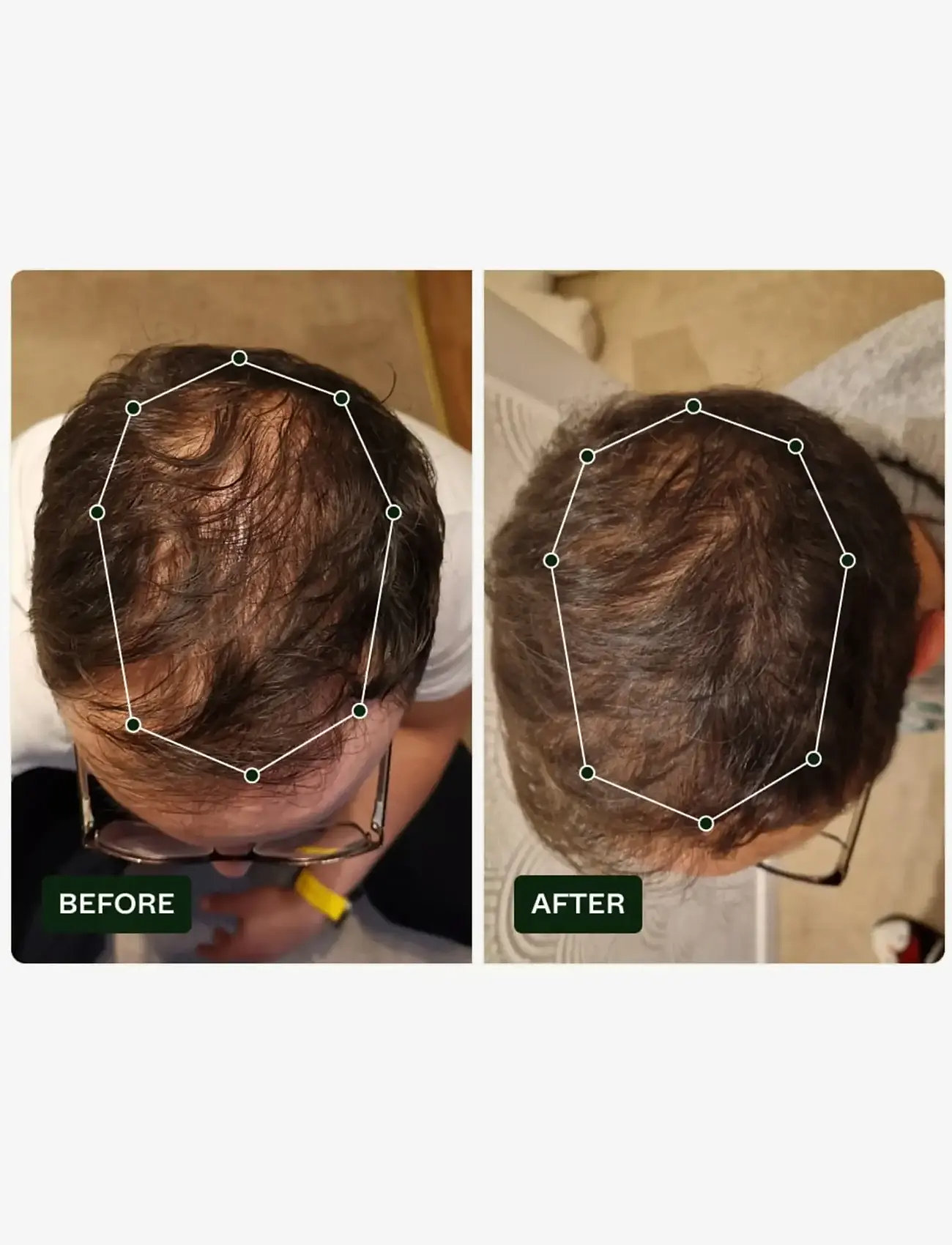 Scandinavian Biolabs - Bio-Pilixin® Serum+ | For Men - hårkur - n/a - 4