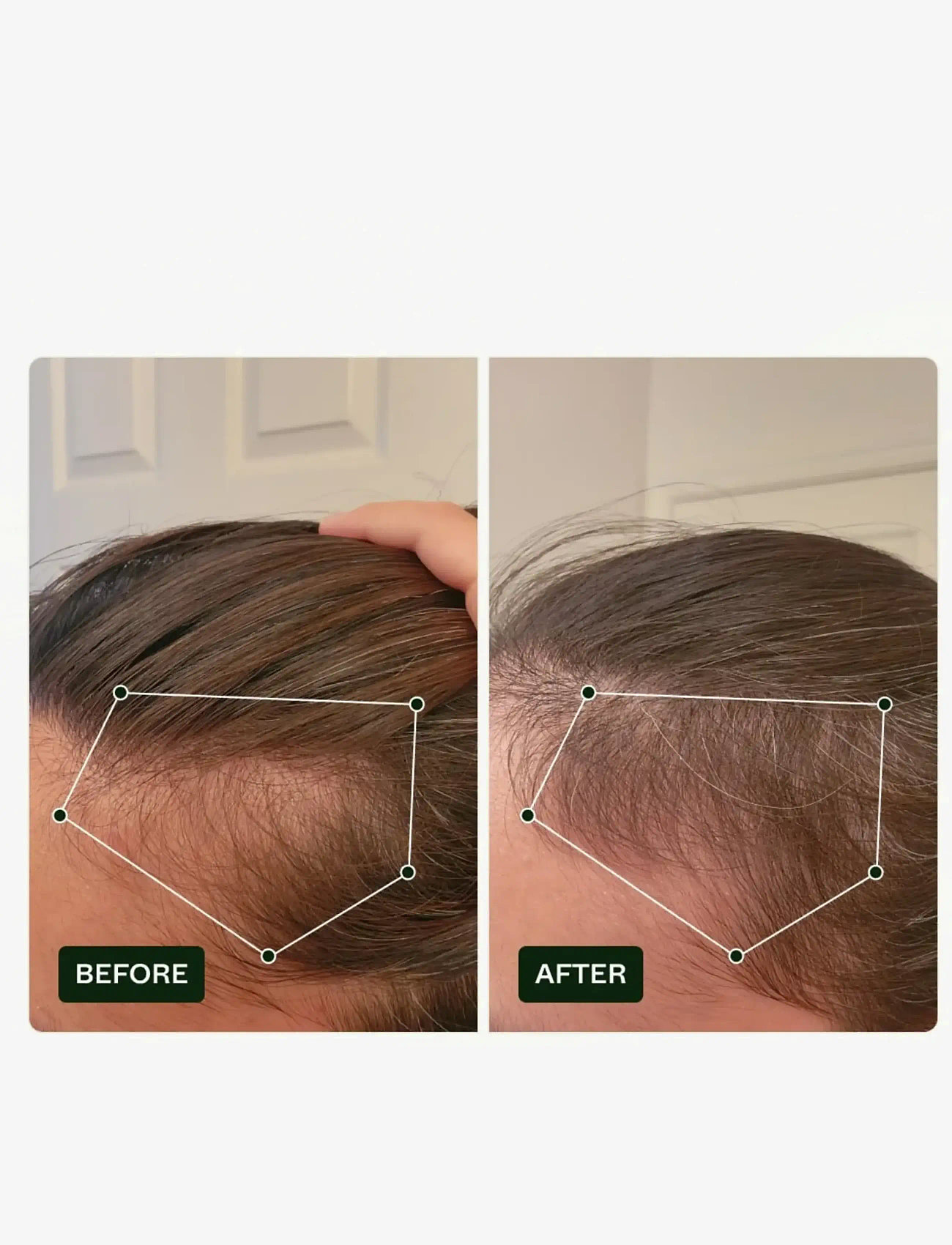 Scandinavian Biolabs - Bio-Pilixin® Serum+ | For Men - hårkur - n/a - 5