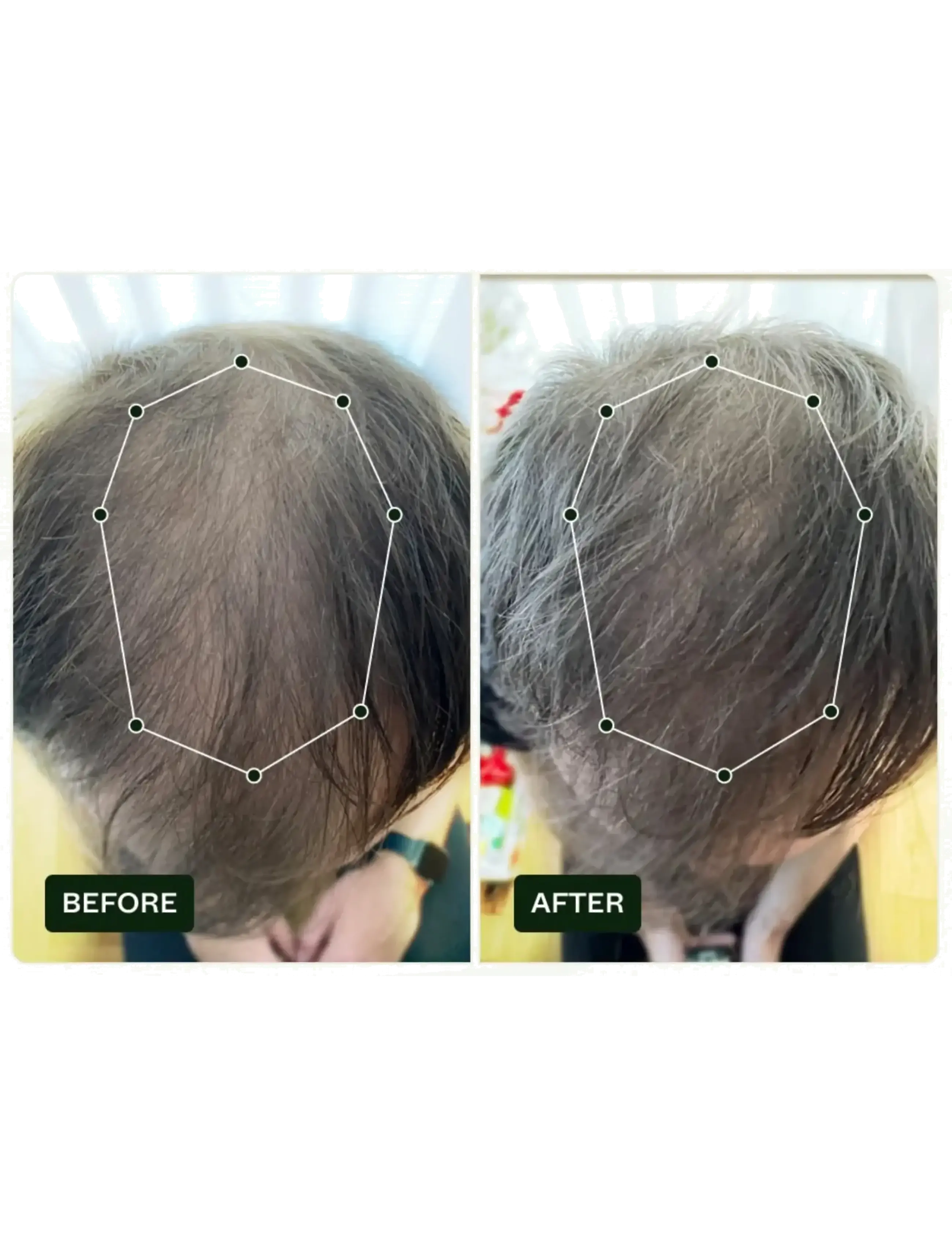 Scandinavian Biolabs - Bio-Pilixin® Serum+ | For Men - hármeðferðir - n/a - 2