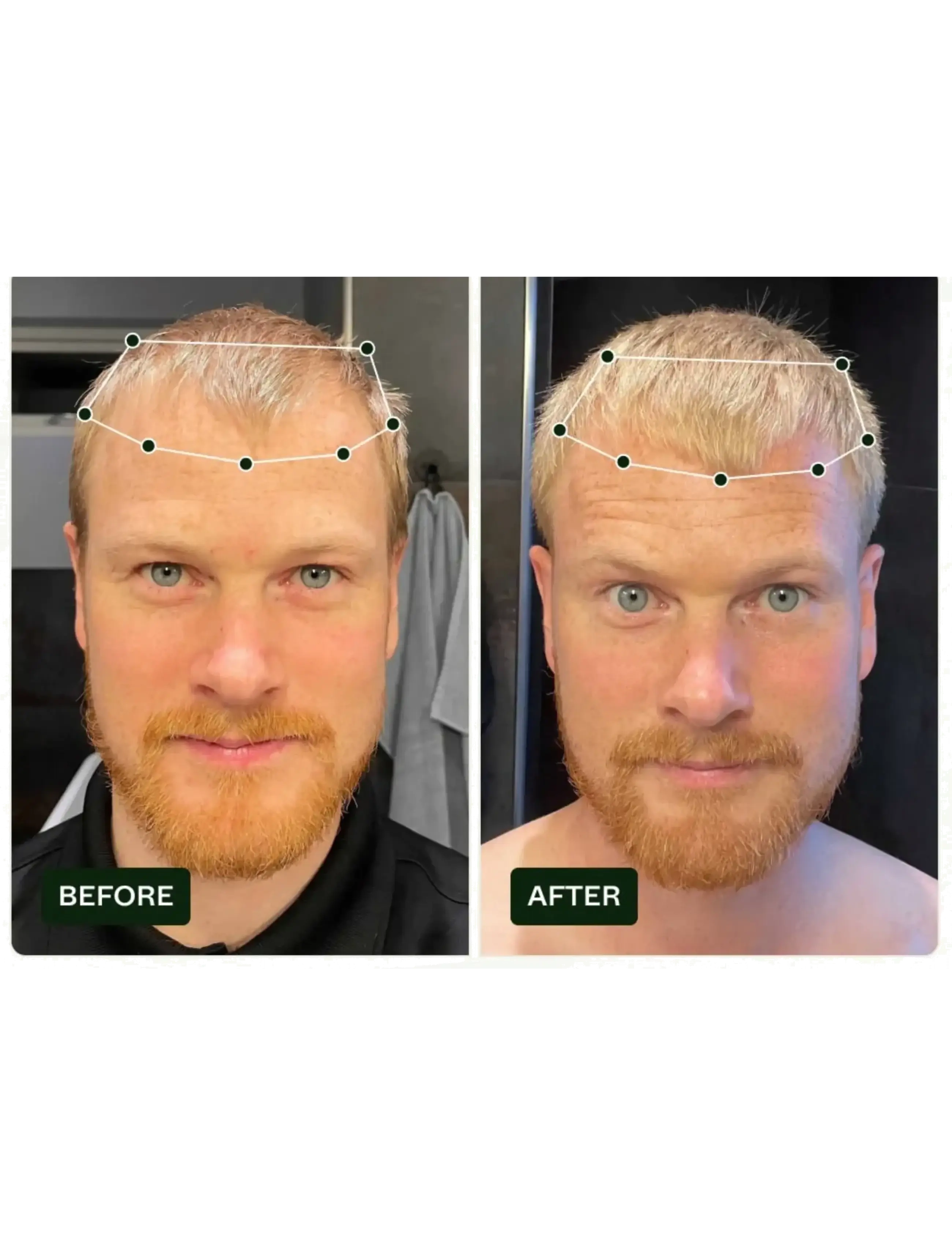 Scandinavian Biolabs - Bio-Pilixin® Serum+ | For Men - hármeðferðir - n/a - 3
