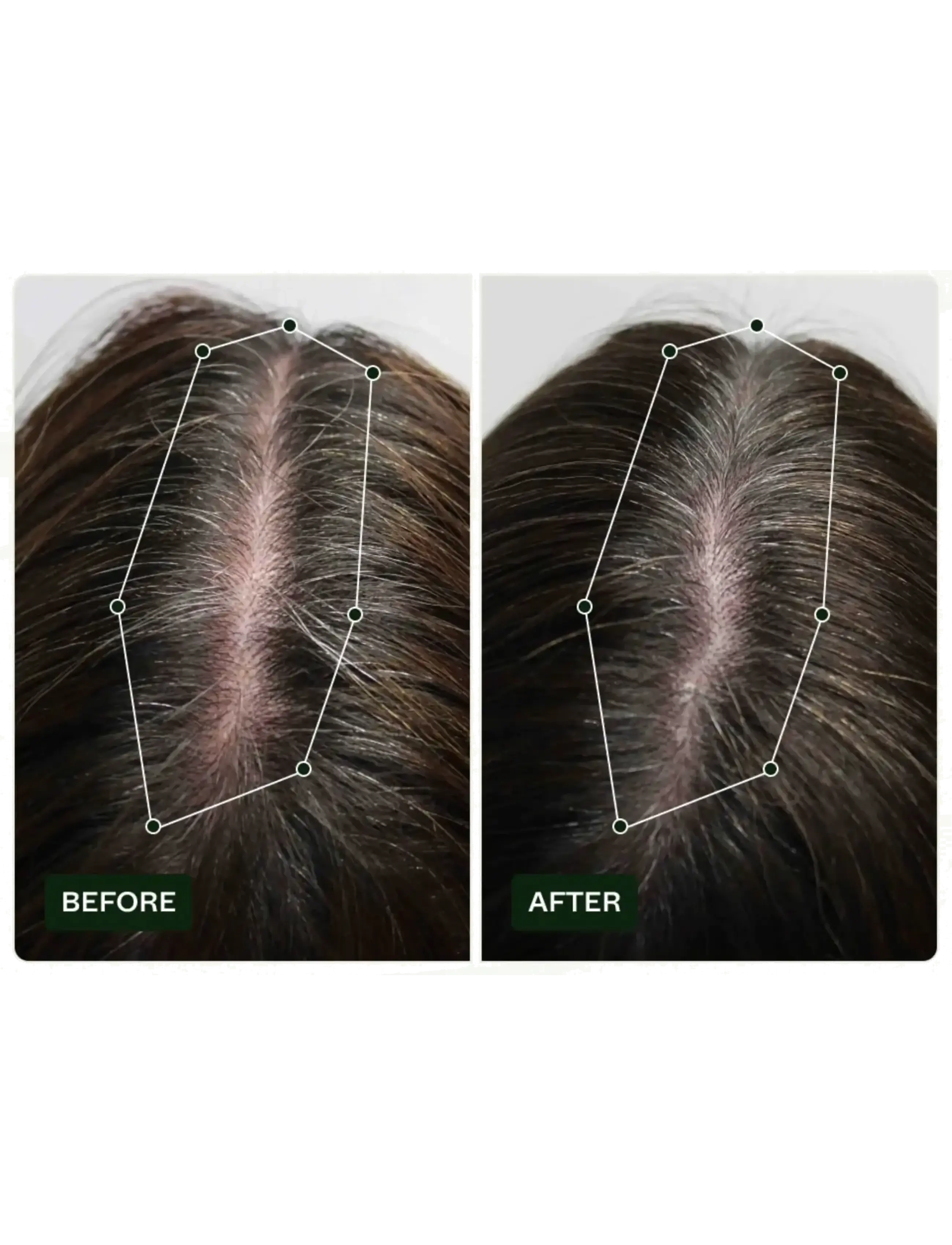 Scandinavian Biolabs - Bio-Pilixin® Serum+ | For Women - scalp treatment - n/a - 3