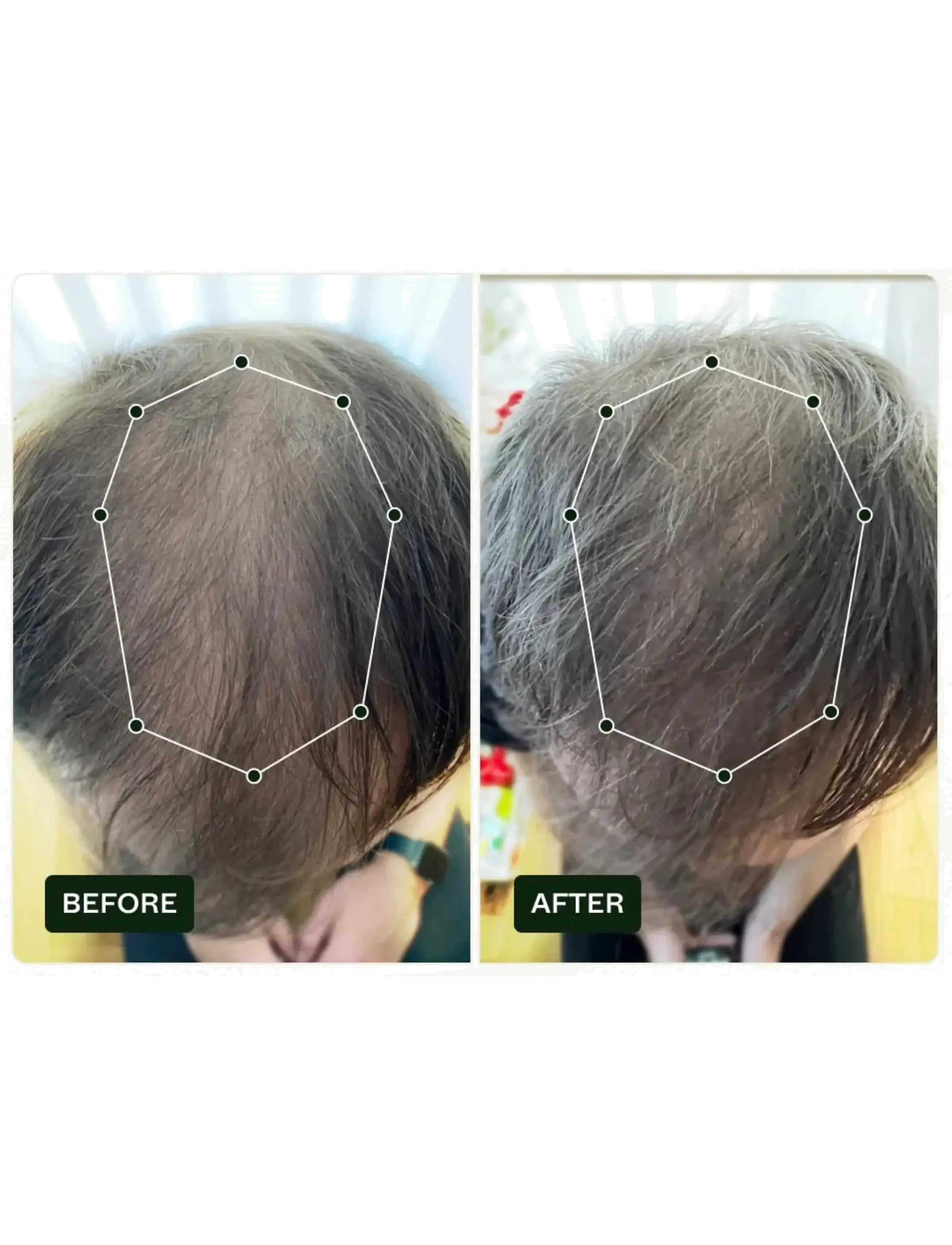 Scandinavian Biolabs - Hair Routine Men (shampoo, conditioner, serum) - hårkur - n/a - 5
