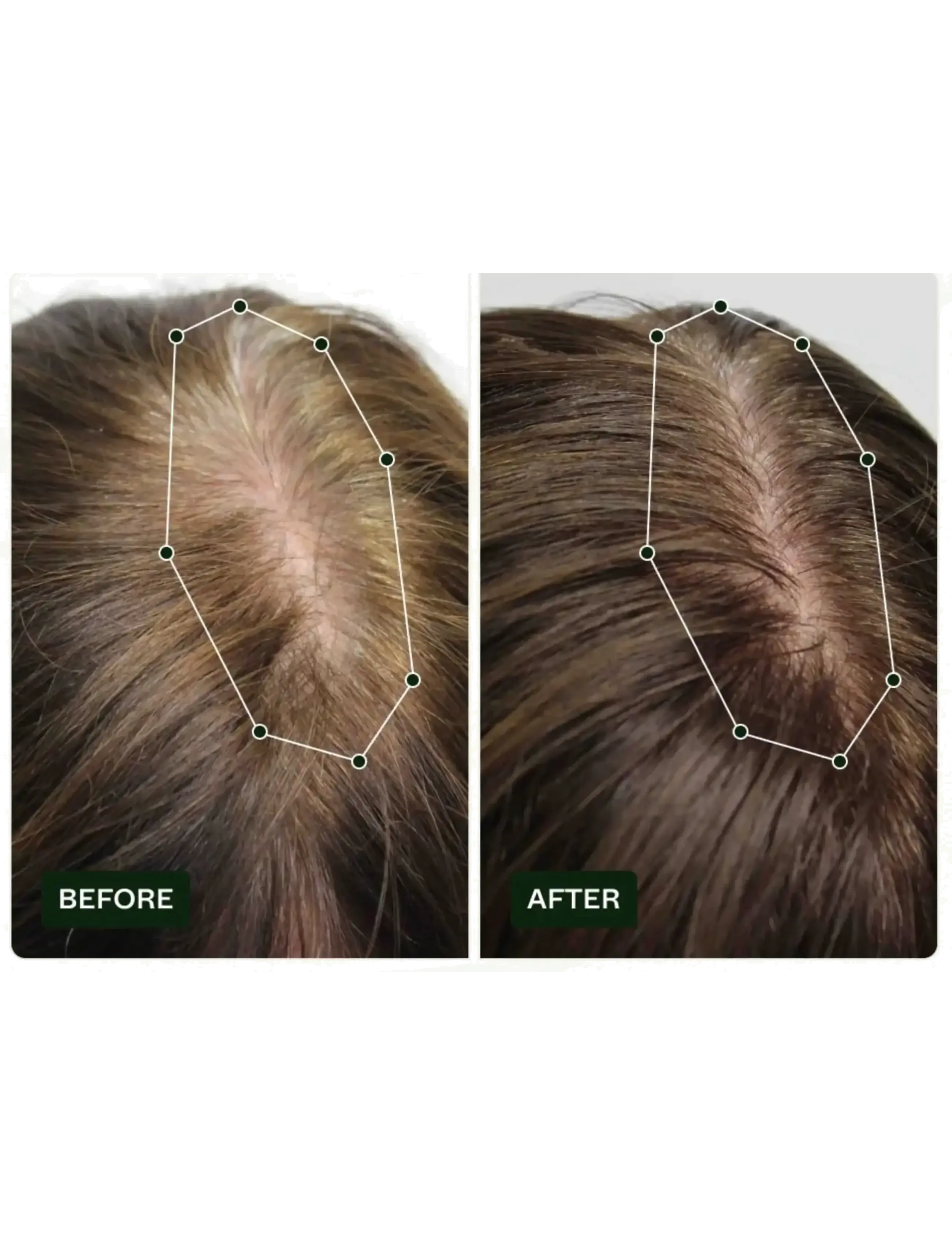 Scandinavian Biolabs - Hair Routine Women (shampoo, conditioner, serum) - hiusseerumit - n/a - 4