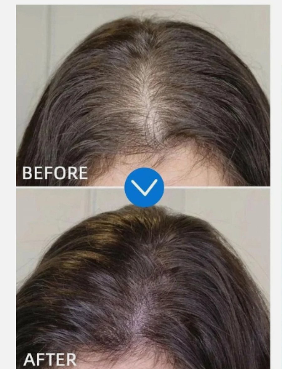 Seapuri - Scalpy Hair Serum - juuksehooldused - clear - 2