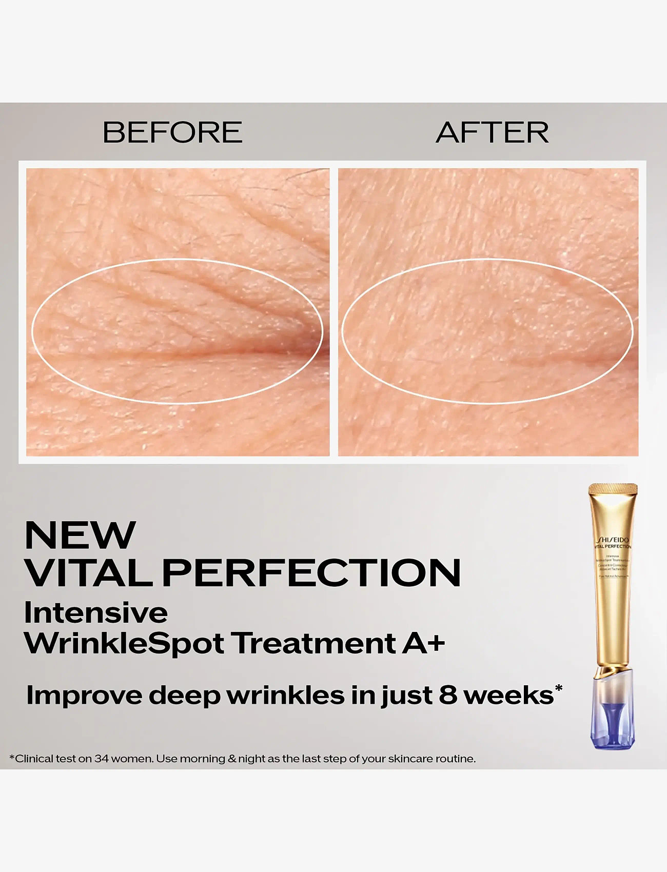 Shiseido - Vital Perfection Intensive Wrinklespot Treatment A+ - hudvård - no color - 1