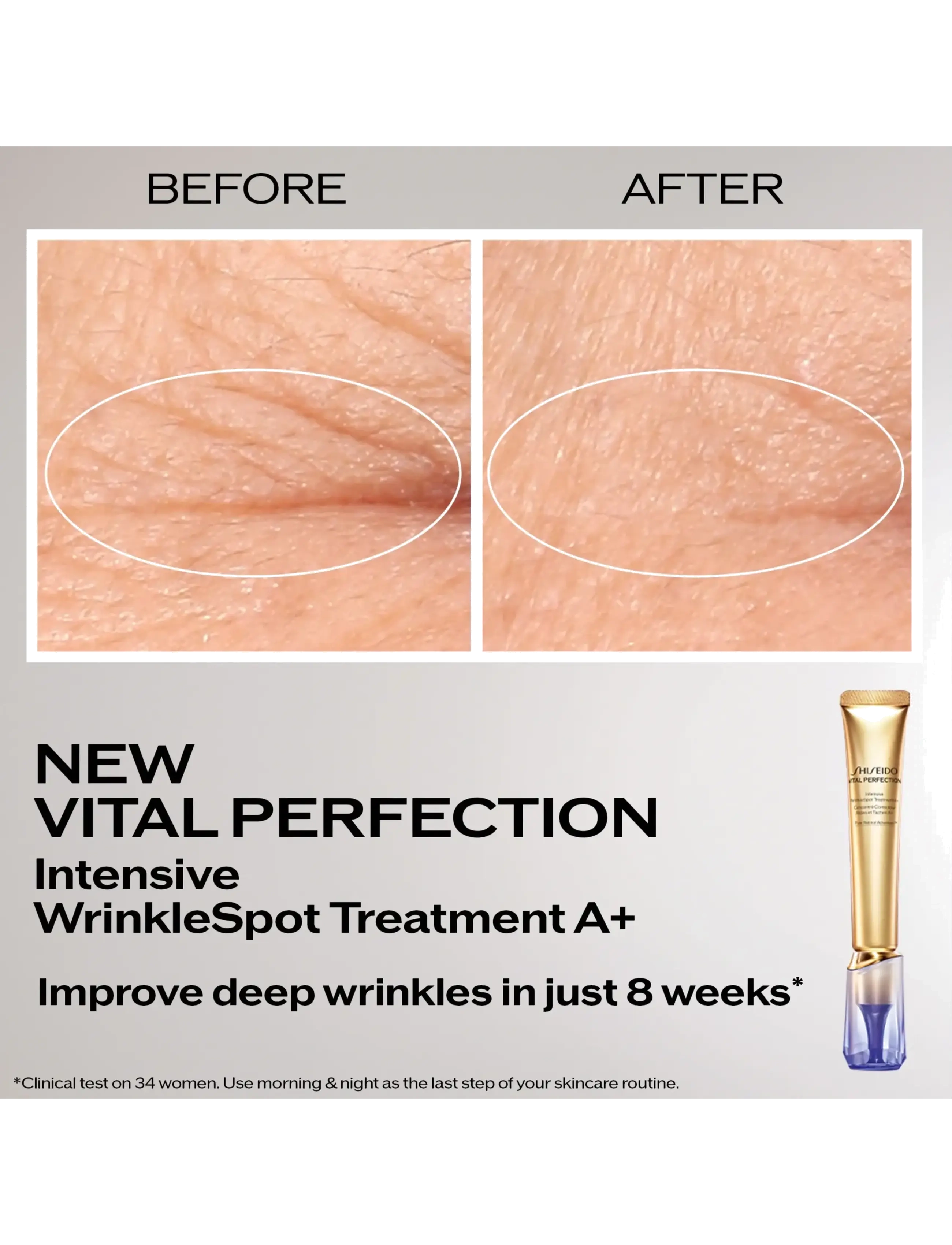 Shiseido - Vital Perfection Intensive Wrinklespot Treatment A+ - no color - 1