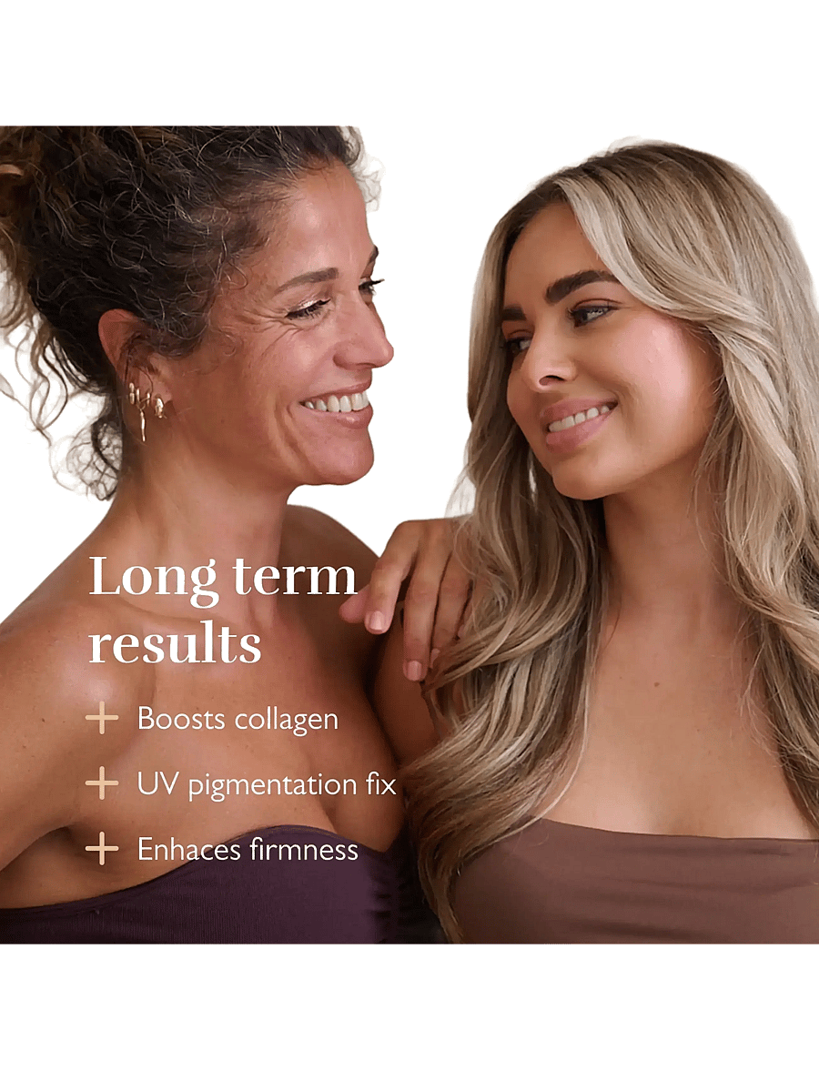 Silk'n - Silk'n LED Chest-Neck Mask Pro wireless - beauty tech - gold - 4