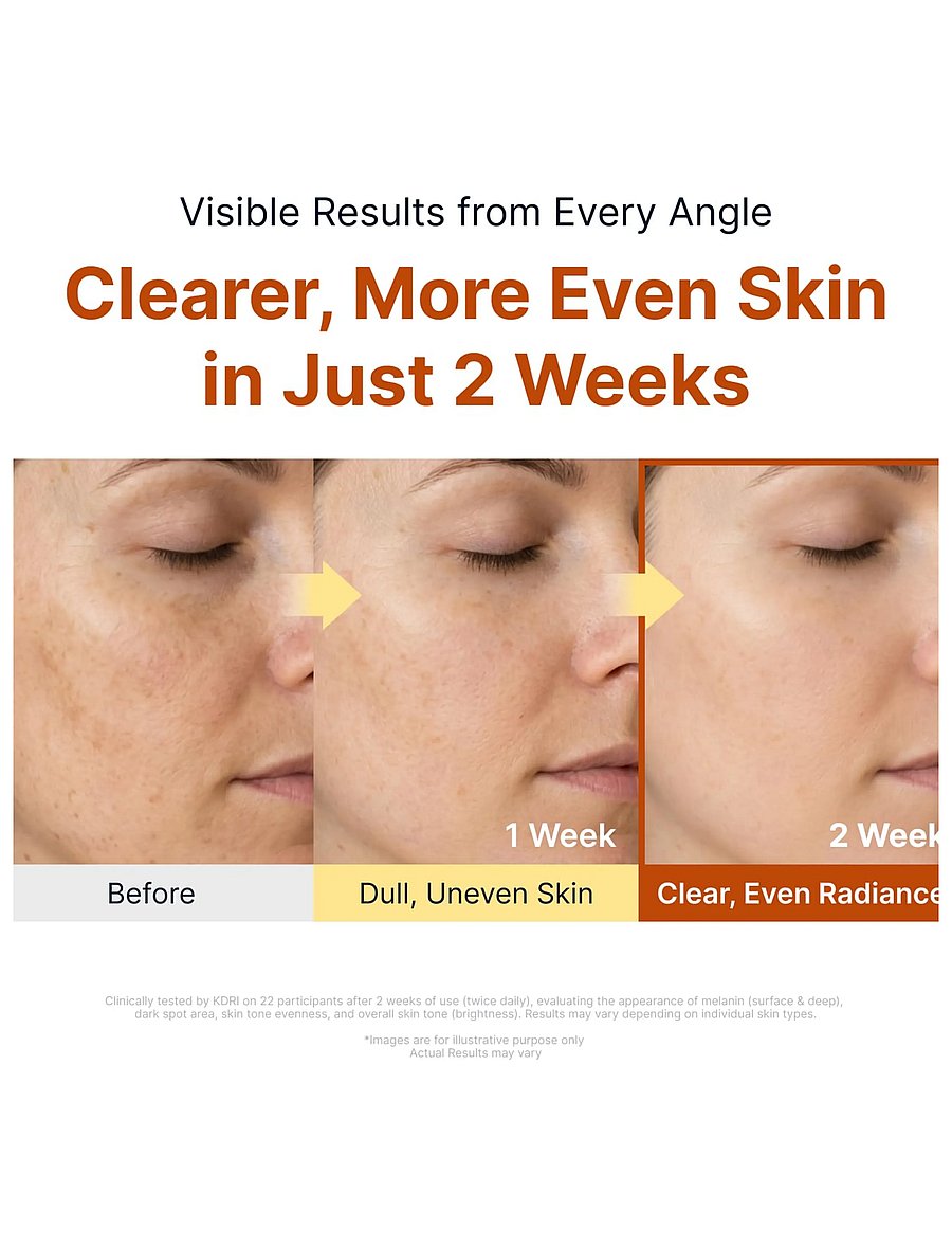 Sungboon Editor - Kojic Acid Niacinamide Brightening Ampoule - clear - 2