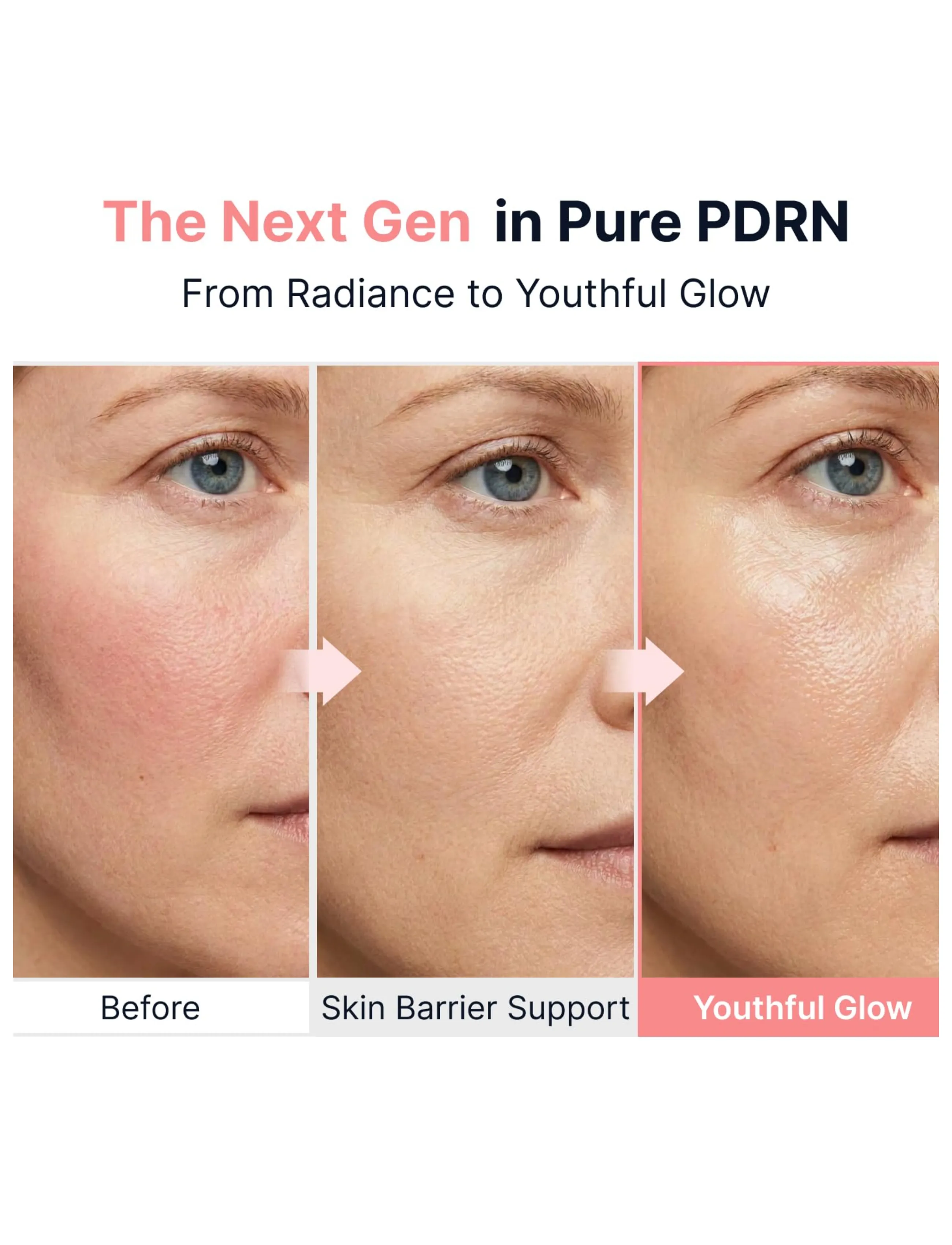 Sungboon Editor - PDRN Pink Vitamin Glow Boosting Ampoule - clear - 2