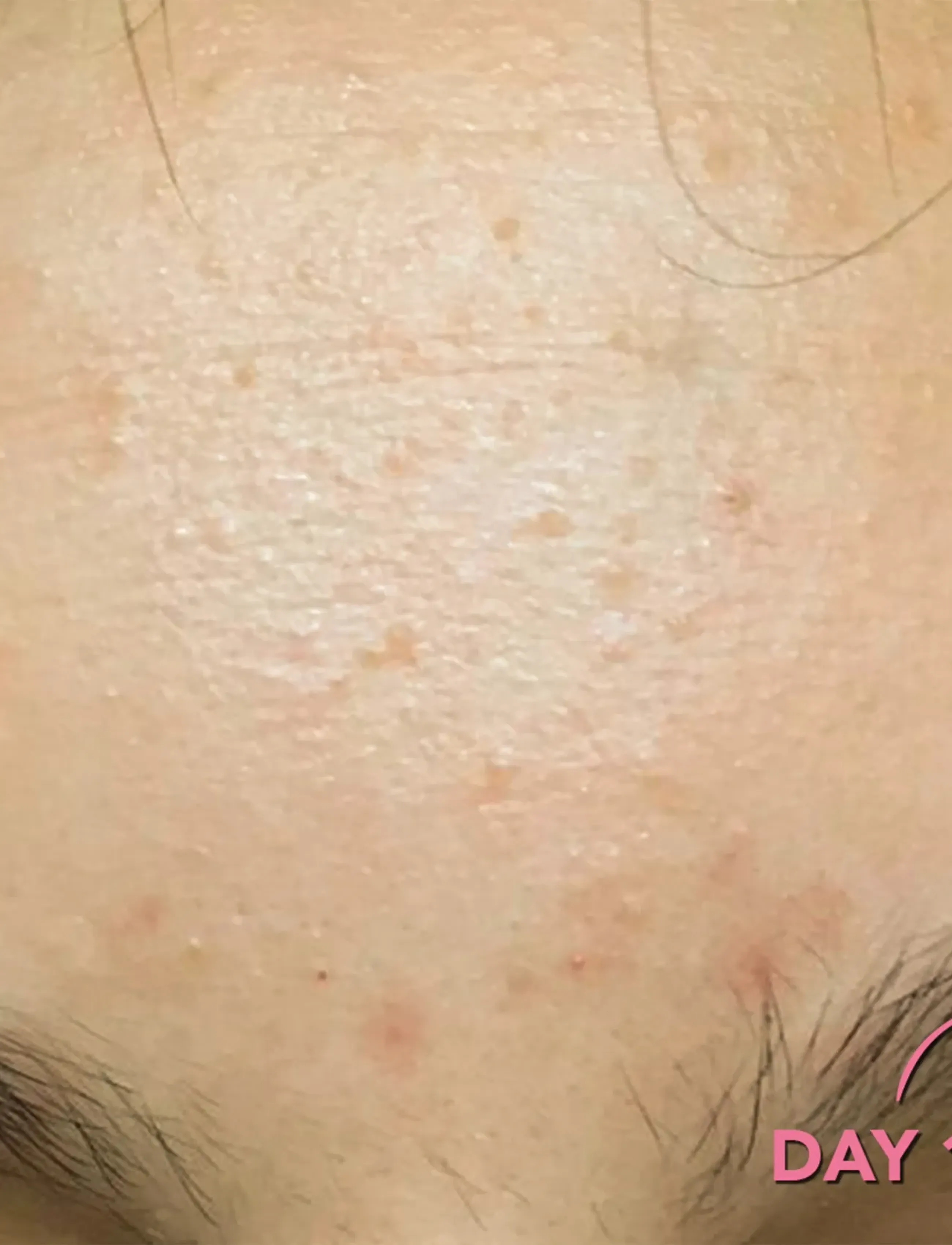 Teaology Skincare - Tea Glow Exfoliating Toner - eksfolierende tonere - green tea - 4