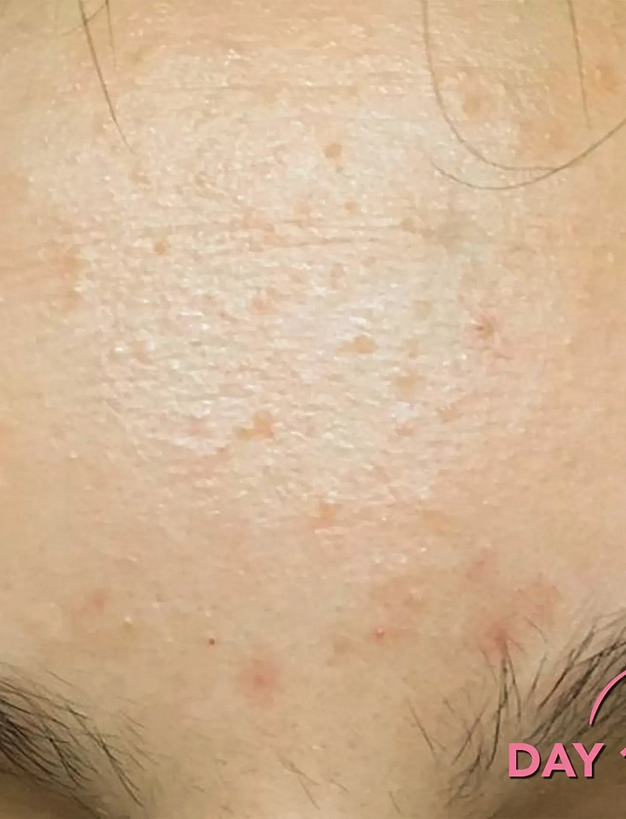 Teaology Skincare - Tea Glow Exfoliating Toner - eksfolierende tonere - green tea - 4
