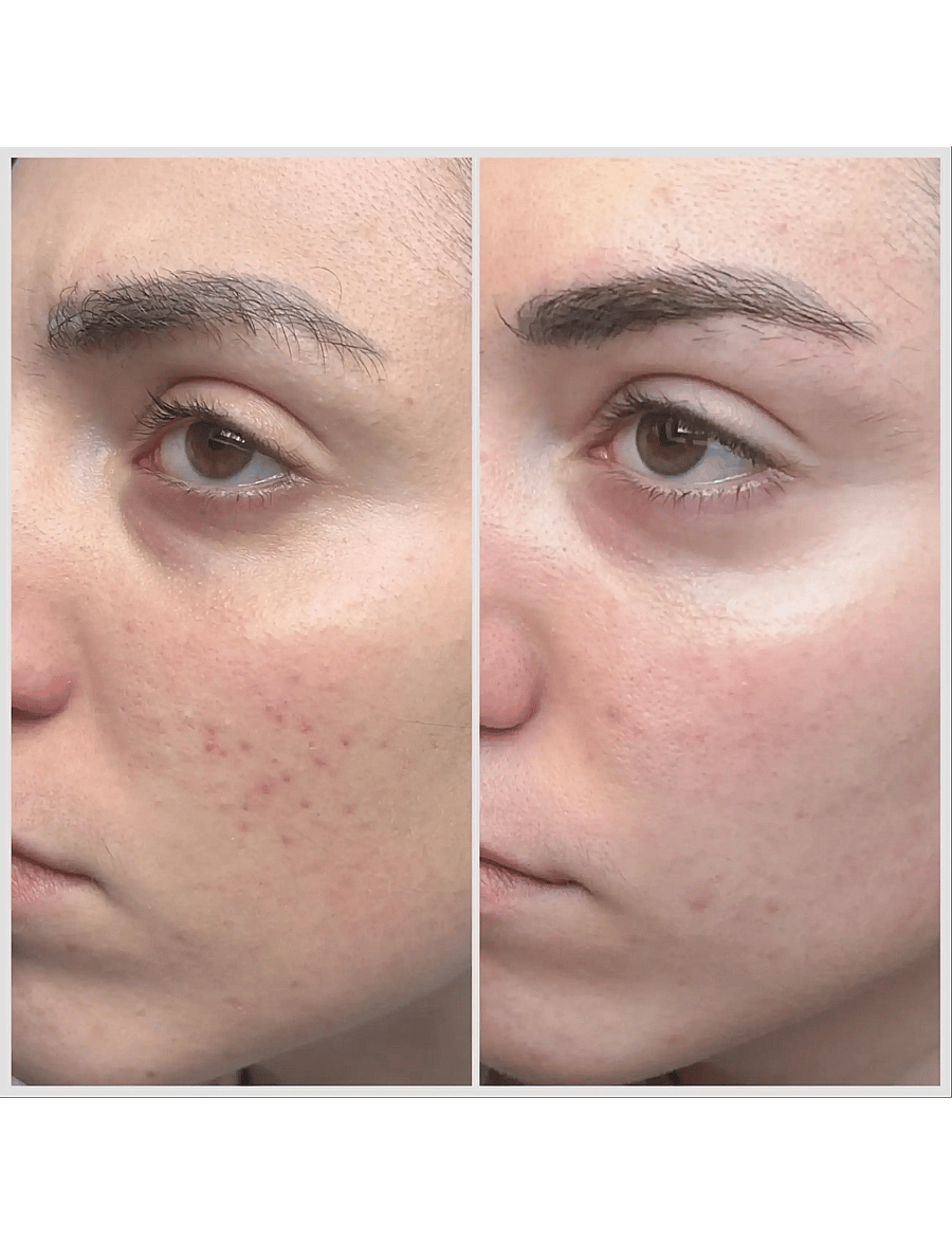 Teaology Skincare - Tea Glow Blemish Cream - dagcremer - green tea - 2