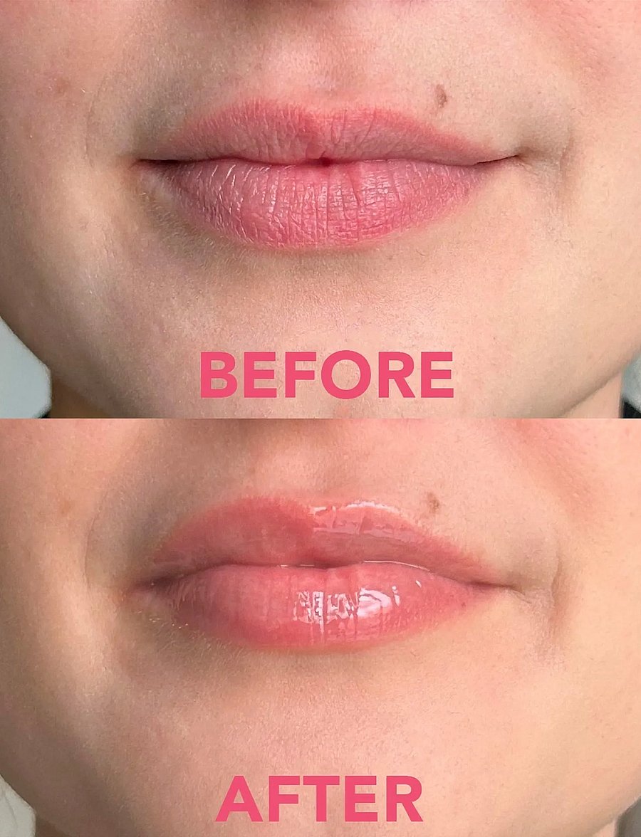 Teaology Skincare - Tea Gloss Volume Lip Treatment | Transparent - redo för date night - white tea - 3