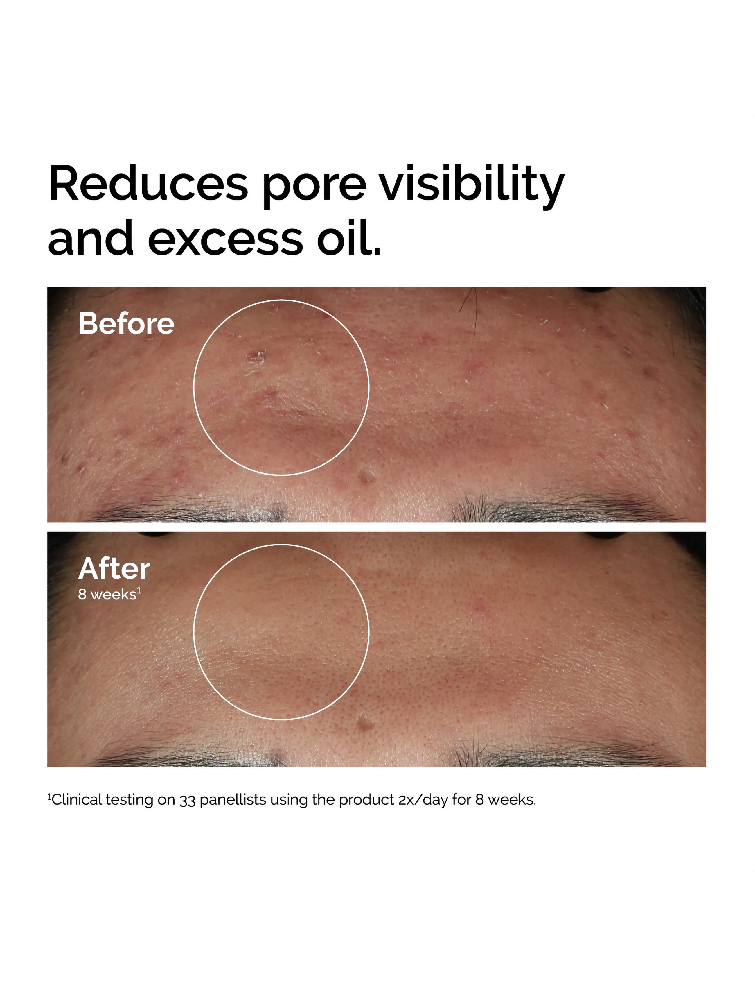 The Ordinary - Niacinamide 10% + Zinc 1% - serum & oljor  - no color - 2