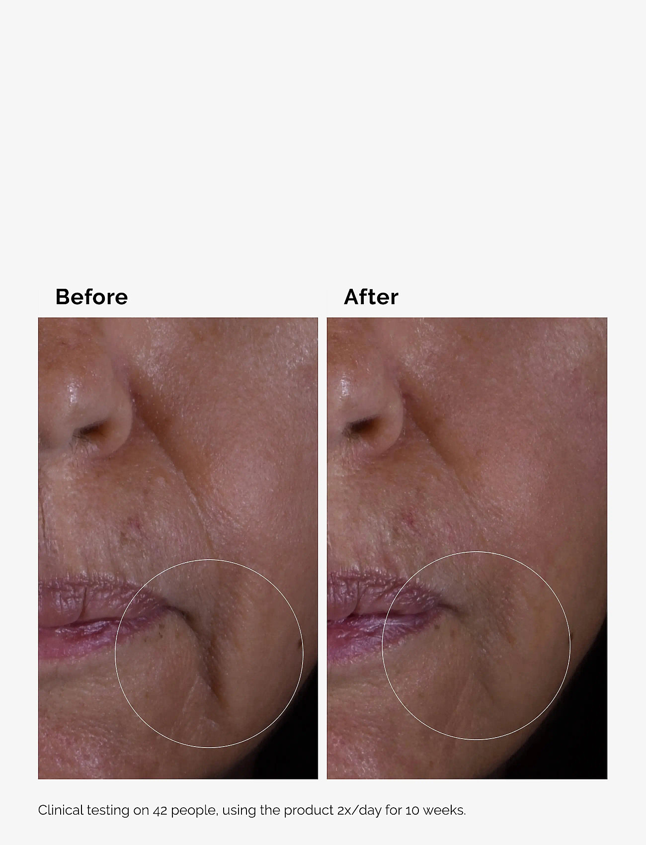 The Ordinary - GF Solution 15% Serum - serum & olier - clear - 4