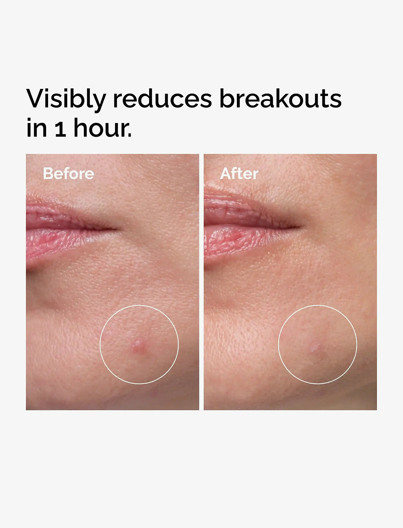 The Ordinary - Sulfur 10% Powder-to-Cream Concentrate - sommarens hudvård  - clear - 2