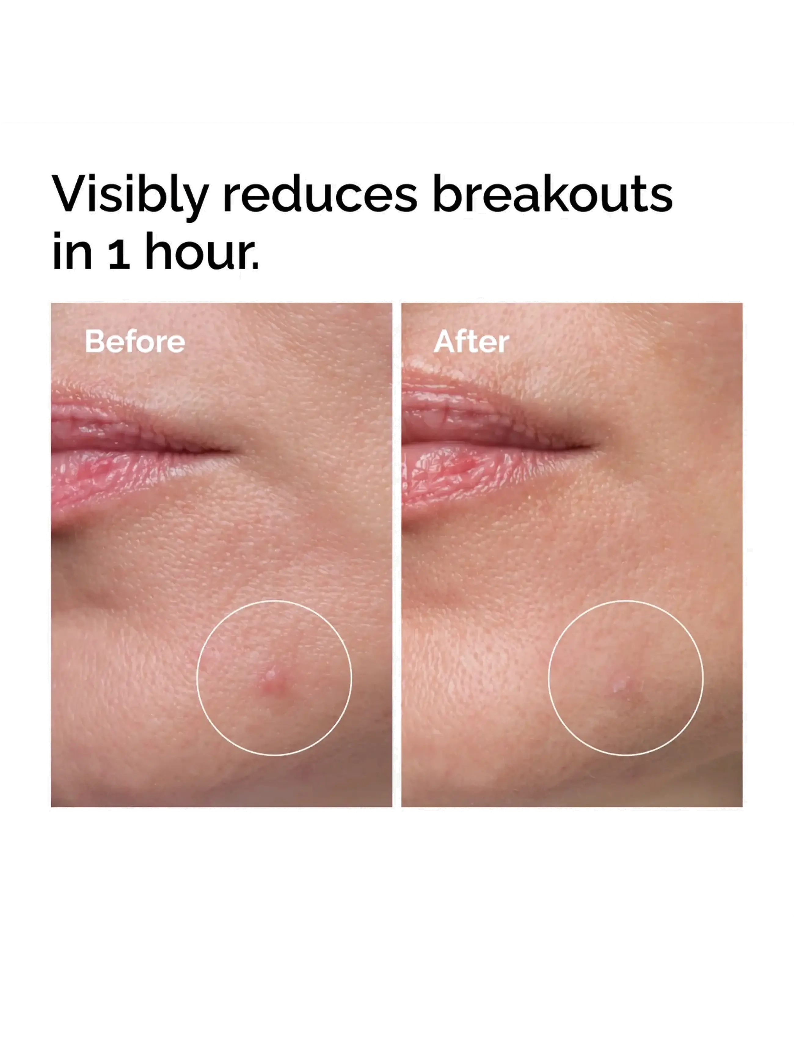The Ordinary - Sulfur 10% Powder-to-Cream Concentrate - kesäiho - clear - 2