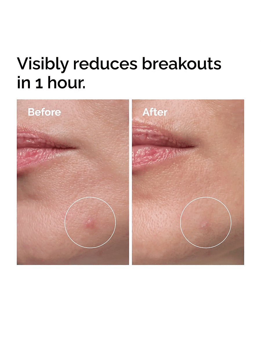 The Ordinary - Sulfur 10% Powder-to-Cream Concentrate - sumarhúð - clear - 2