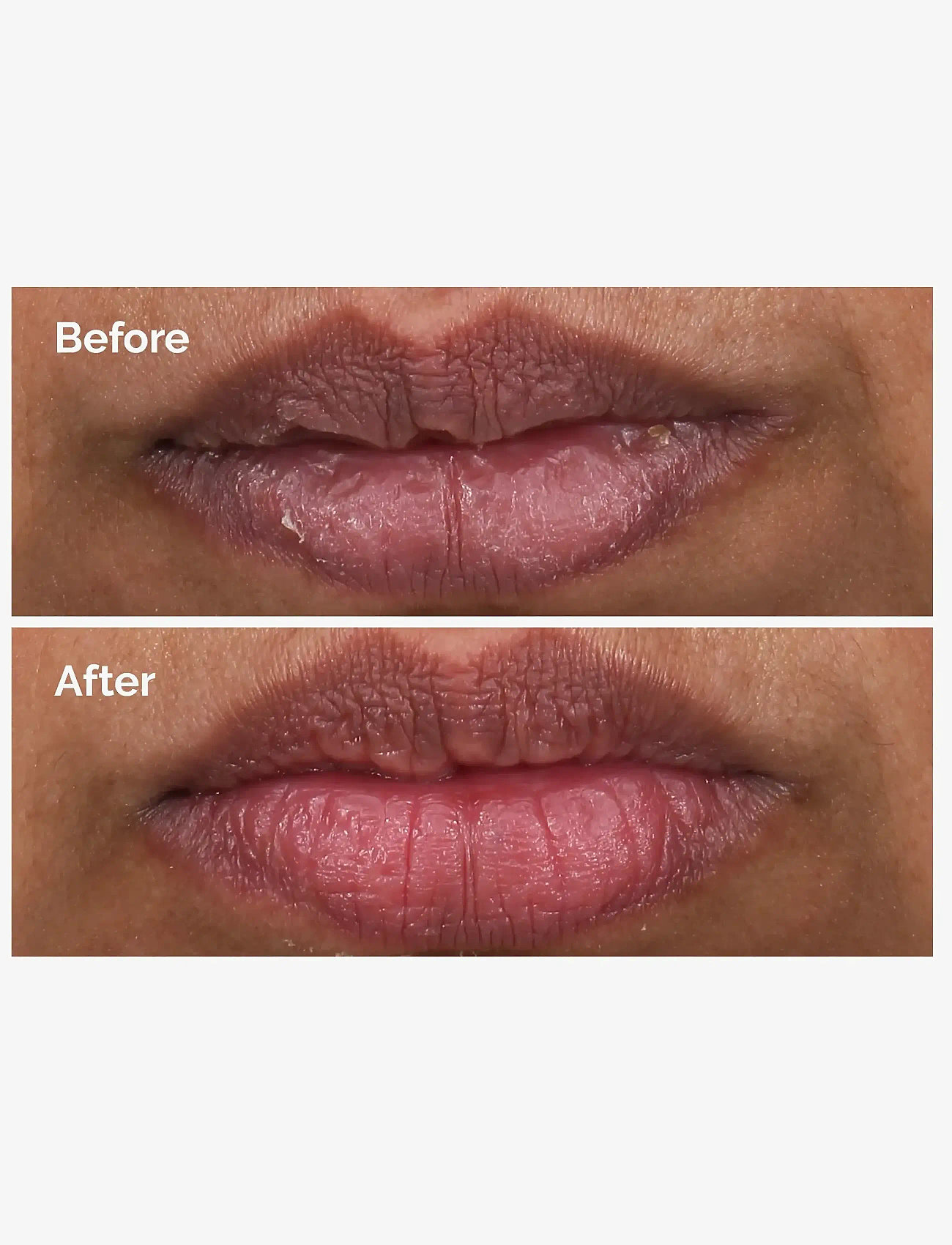 The Ordinary - PHA 5% Exfoliating Lip Serum - läppmasker - clear - 2