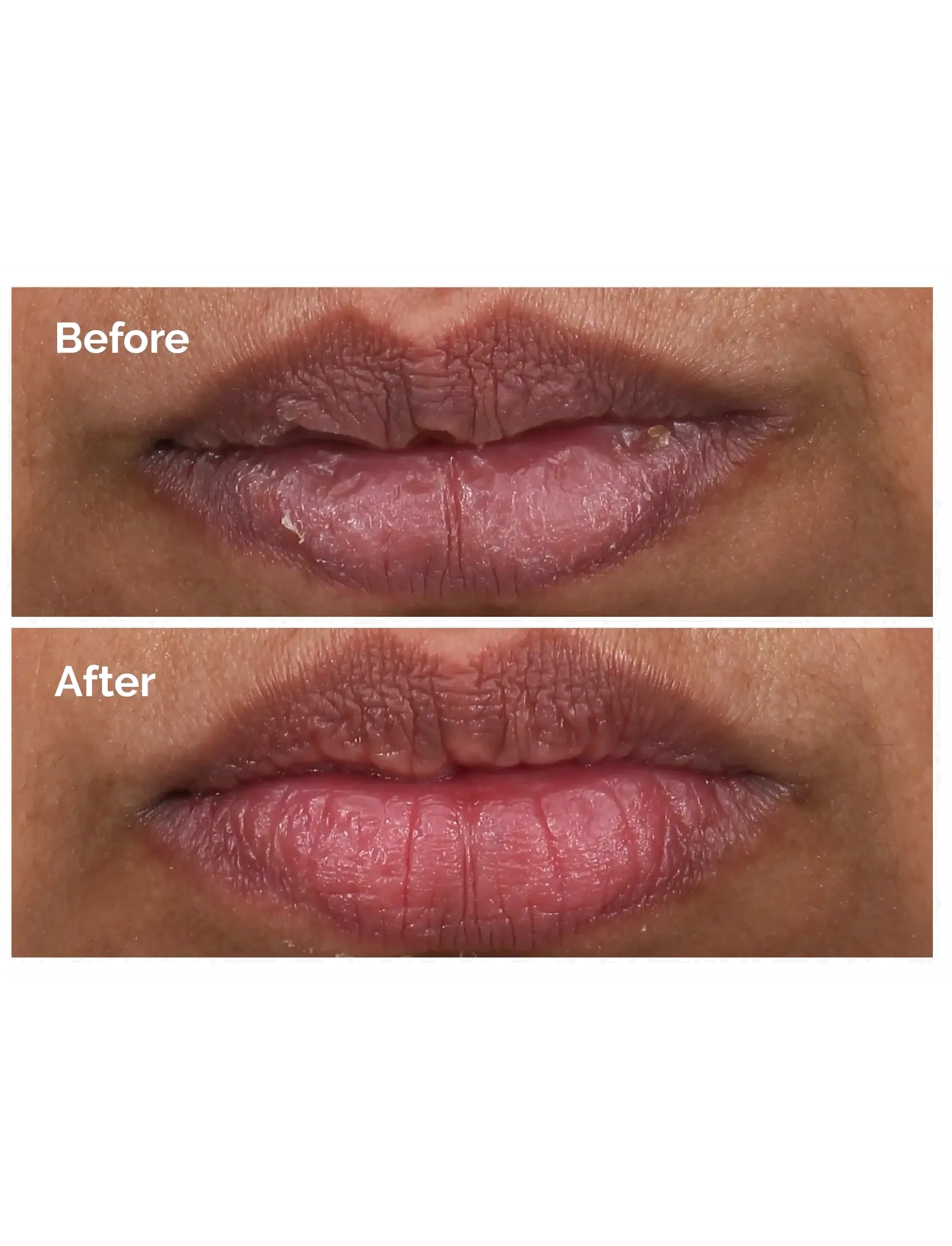 The Ordinary - PHA 5% Exfoliating Lip Serum - varamaskar - clear - 2