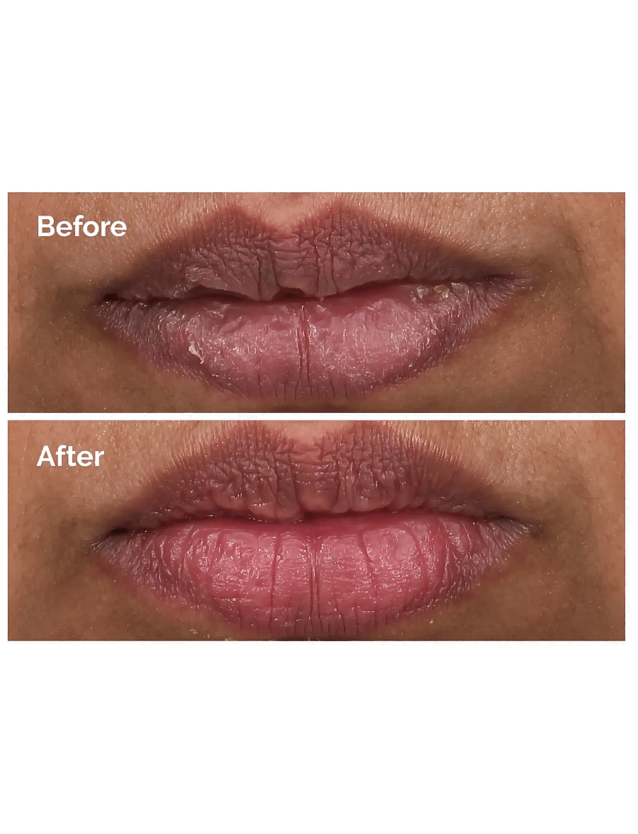 The Ordinary - PHA 5% Exfoliating Lip Serum - varamaskar - clear - 2