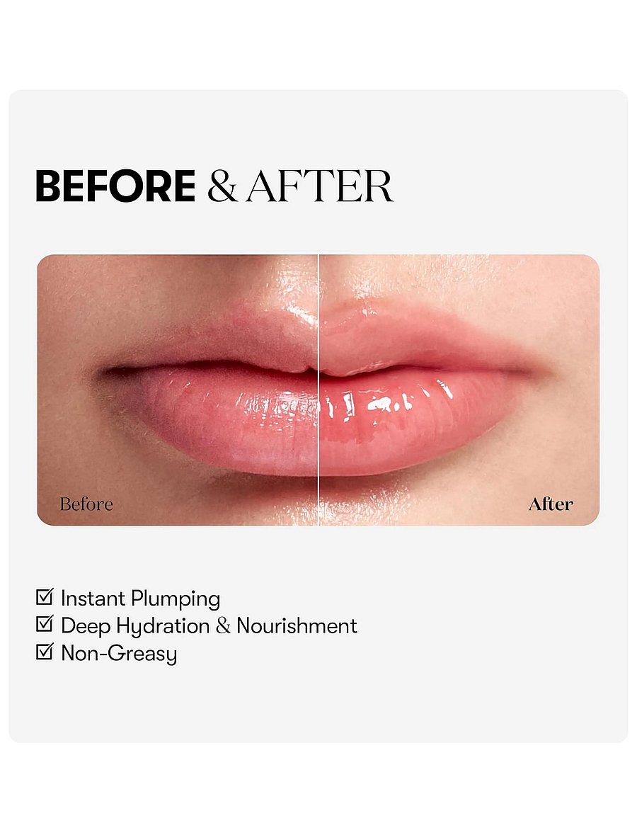 VT Cosmetics - Reedle Shot Lip Plumper - makeup - clear - 2