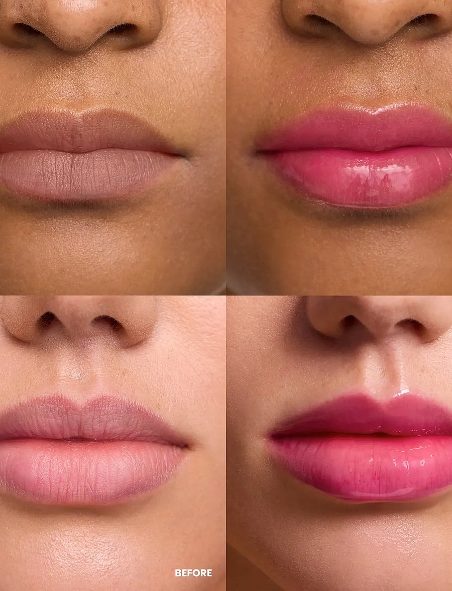 Wonderskin - Lip Rehab Serum Oil - redo för date night - kissed - 0