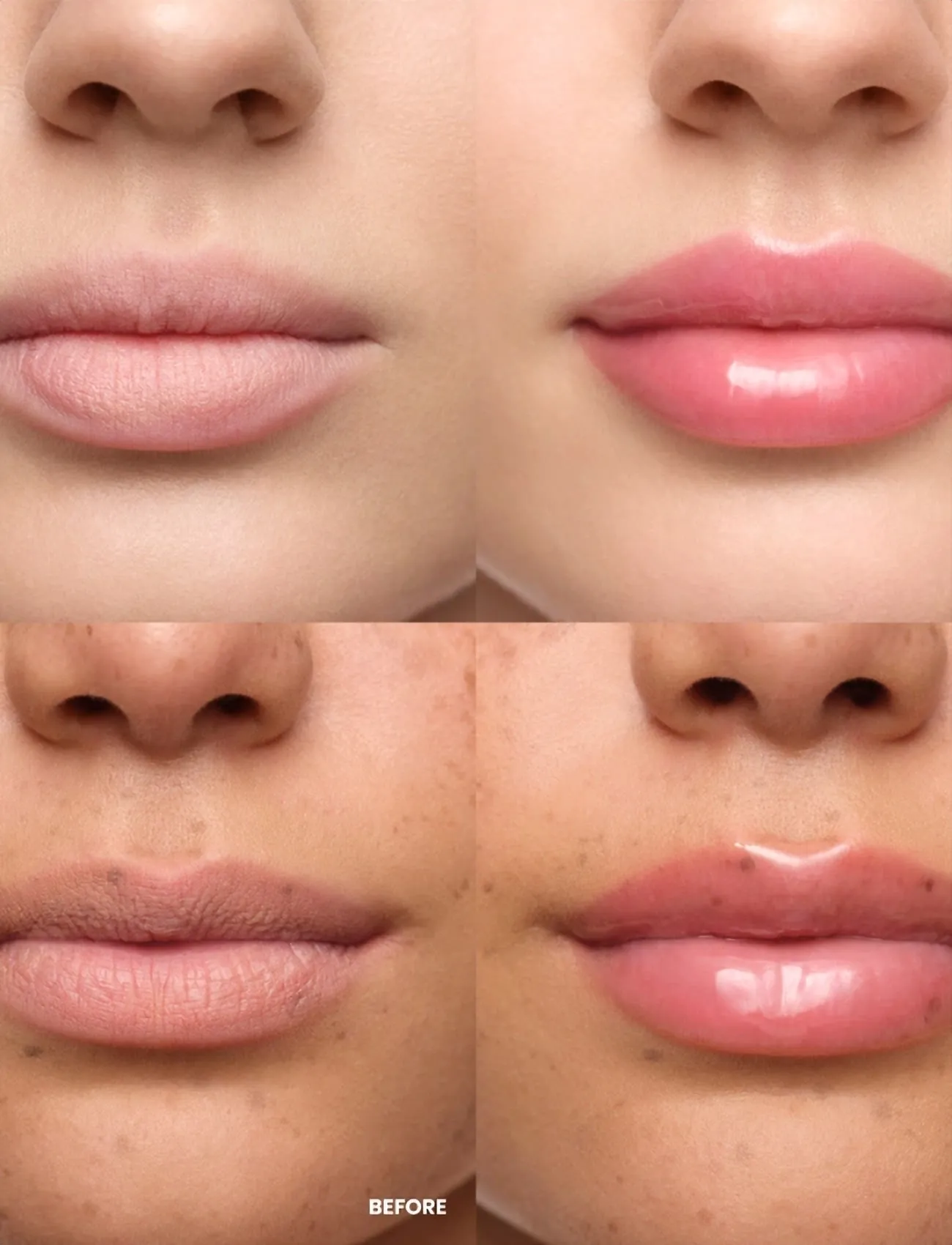 Wonderskin - Lip Relapse Plumping Gloss - makeup - clear - 2